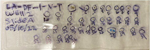 Extracted microplastics on a specimen slide_Samiksha Singh